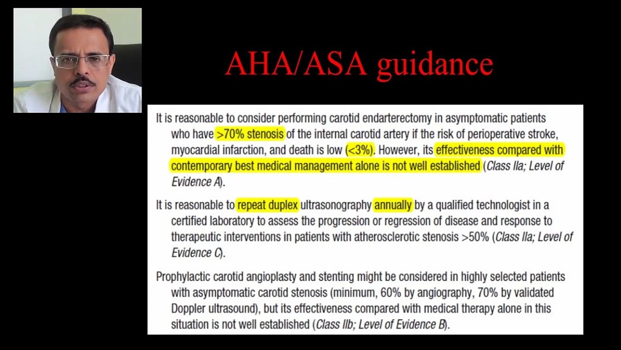 Popular Videos - Carotid artery stenosis & Carotid stenting
