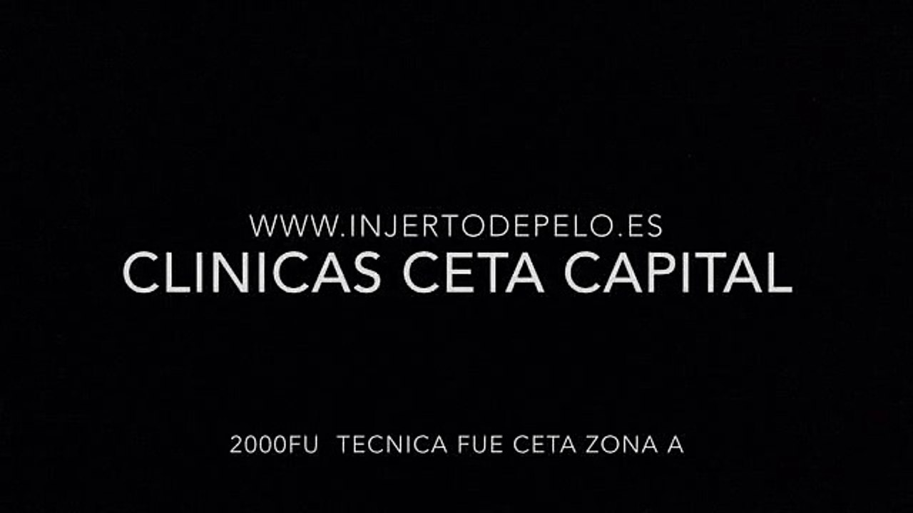 CLINICAS CETA CAPITAL www.injertodepelo.es