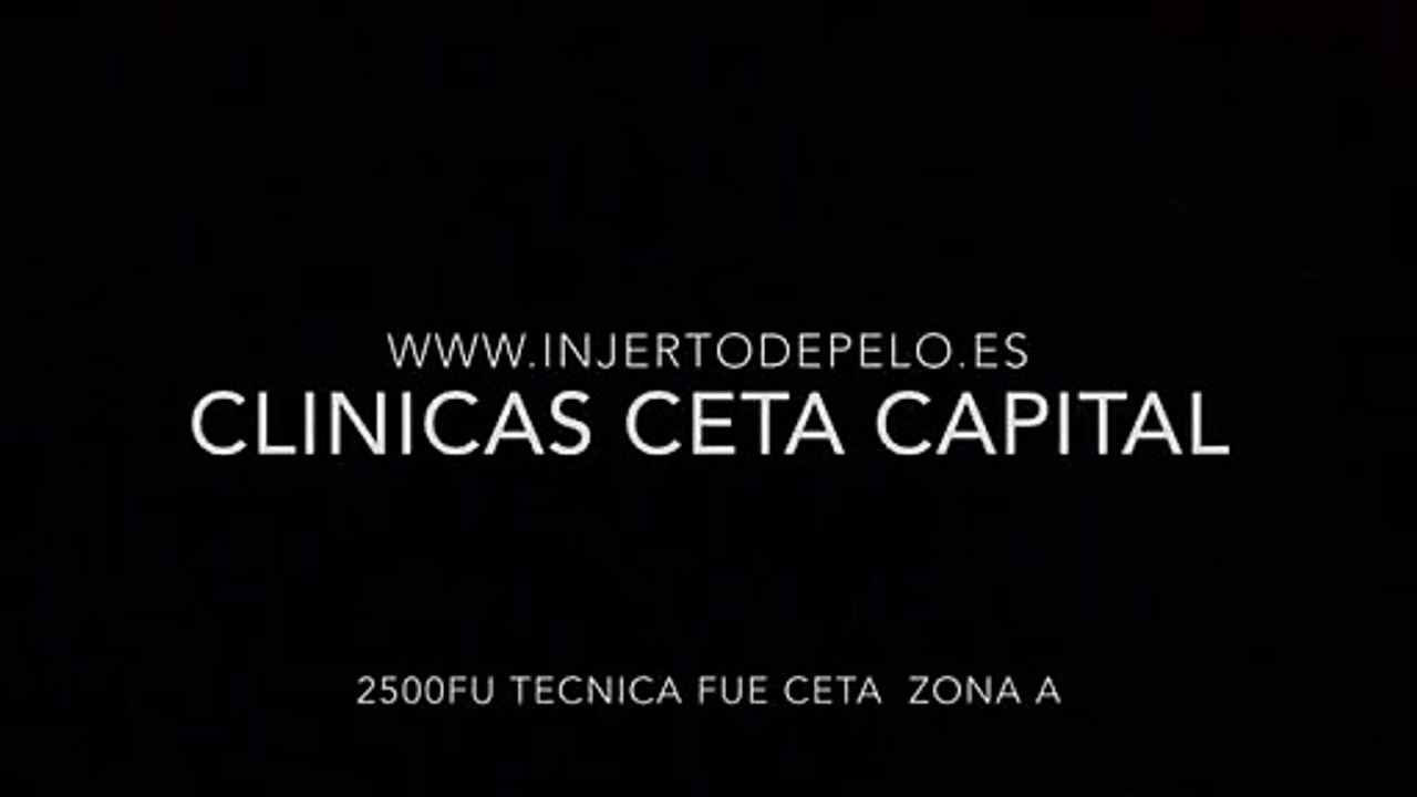 CLINICAS CETA CAPITAL www.injertodepelo.es