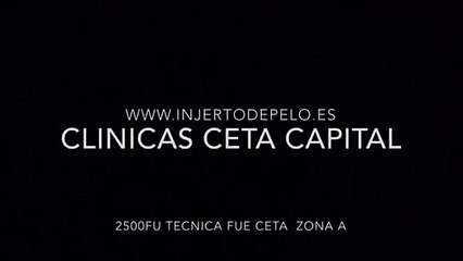 CLINICAS CETA CAPITAL www.injertodepelo.es