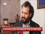 Karakolda Avukata Polis dayağı Polise direndi diye 1 yıl hapsi isteniyor