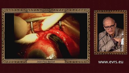 Retinal Detachment Problems_1