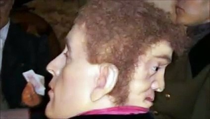 Edward Mordake - The man with two faces