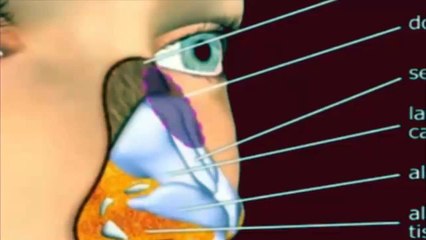 عملية واقعية لتجميل الانف