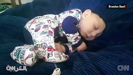 طفل مولود دون جزء من جمجمته يكمل عامه الأول