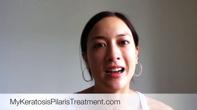 Bumpy Arms? Keratosis Pilaris: Best Treatment Options - OnlineDermClinic