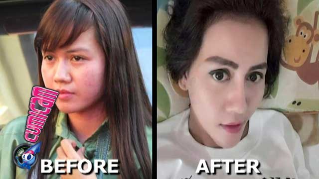 Cantik Plastik Nita Thalia - Cumicam 19 Oktober 2015