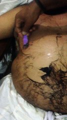 CarePlus hair remover spray