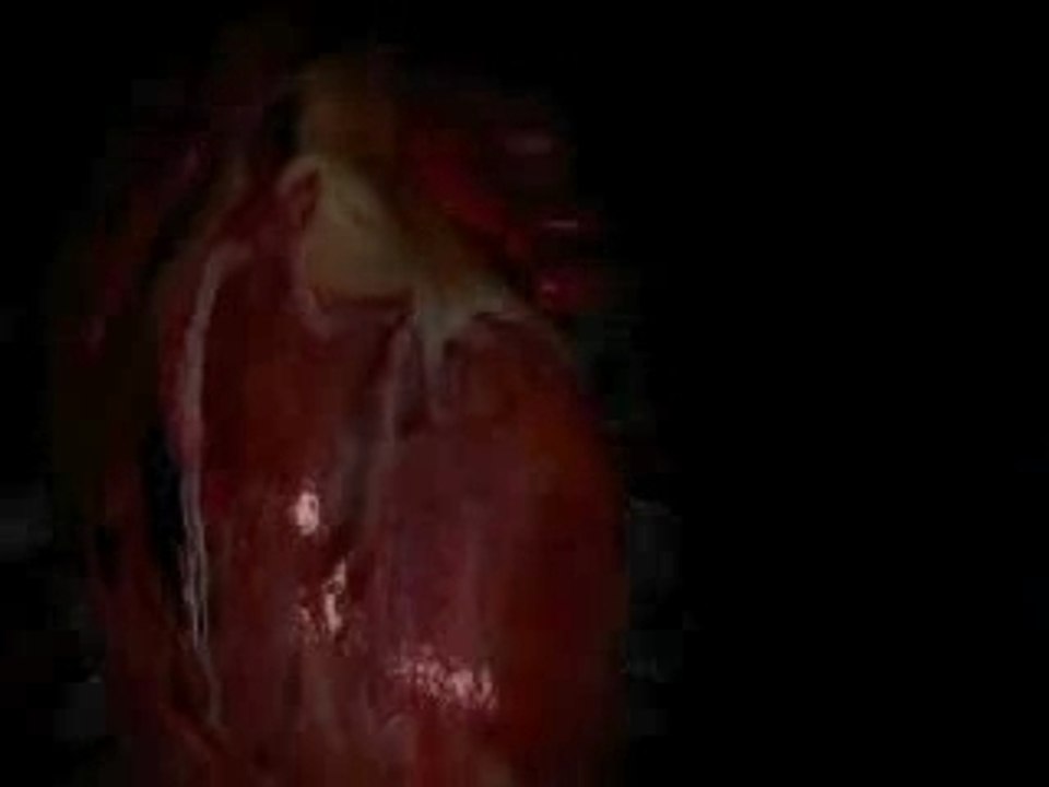 préavis de la mort tecktonik