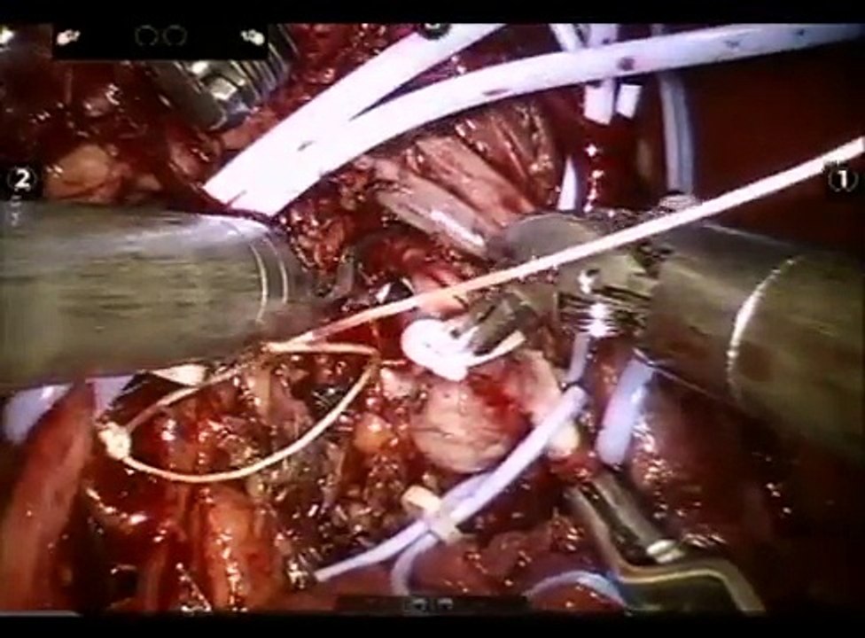 Kurt Strom MD