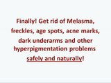 Natural HYPERPIGMENTATION Skin Care for Acne Scars, Melasma, Dark Spots, Uneven Skin, Disc