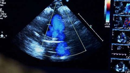 Fault Lines - America’s Infant Mortality Crisis promo