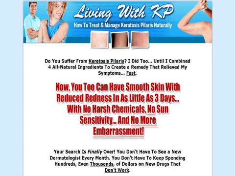 How to Treat & Manage Keratosis Pilaris Naturally.