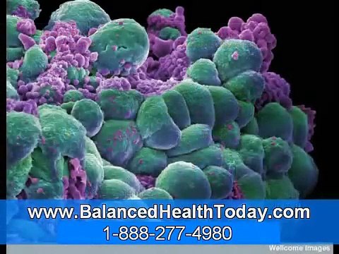 Natural and Effective Alternative Treatments for Prostate Cancer Part 1