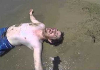 Runner Takes a Painful Spill on the Beach