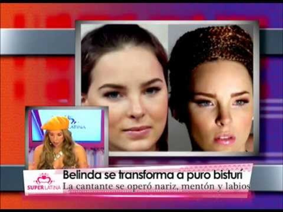 Famosas antes y después de una cirugía de nariz - Gabriela Natale