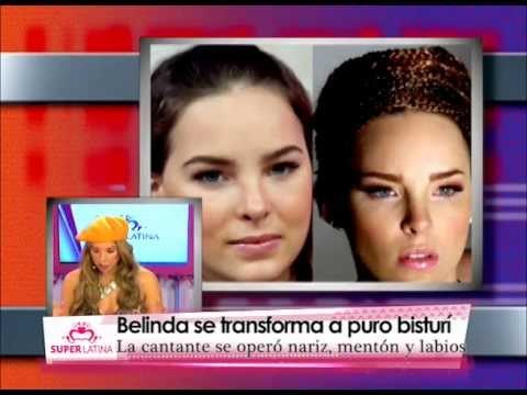 Famosas antes y después de una cirugía de nariz - Gabriela Natale