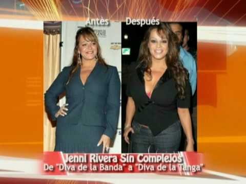 Cirugías de las Famosas: Antes y Después - Gabriela Natale