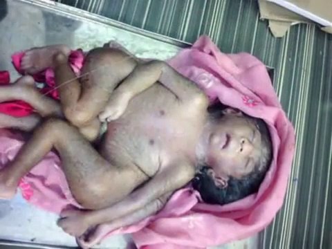 Thousands of devotees have flocked to see a baby born with 8 limbs to worship him as a Hin