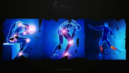 Affordable Orthopedic Surgery in Turkey