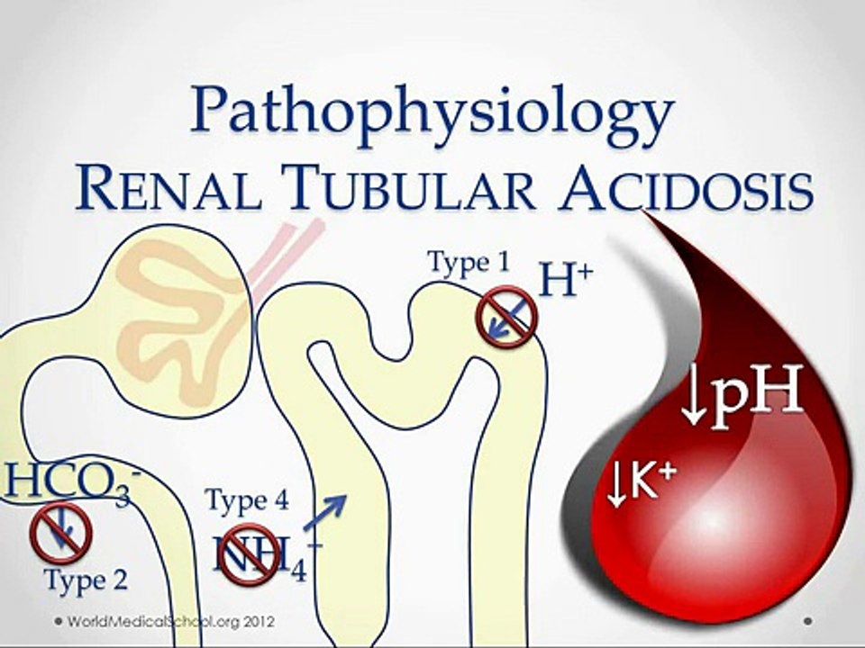 Renal Tubular Acidosis - USMLE STep 2 Review