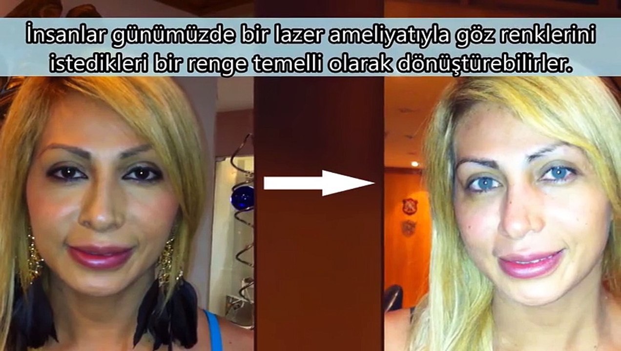 Gözleriniz Hakkında Bilmediğiniz 11 Şaşırtıcı Bilgi