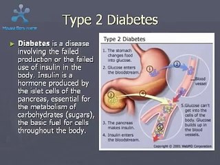 Medical Videos  Type 2 Diabetes Causes Symptoms and Treatment