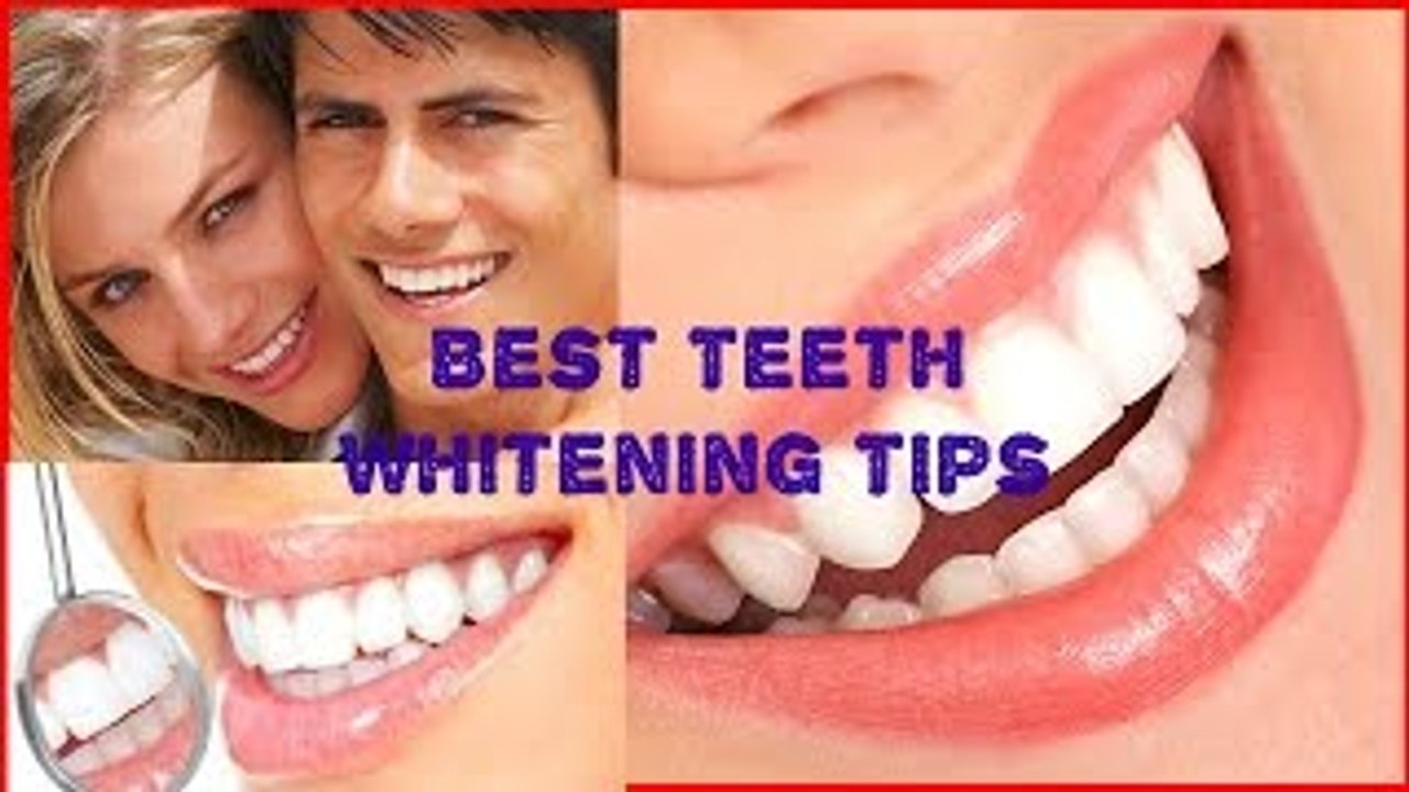 Best Teeth Whitening Tips video Dailymotion