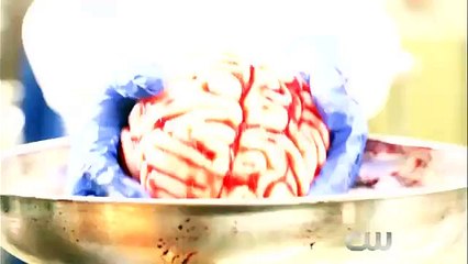 iZombie 2x02 Promo Zombie Bro (HD)