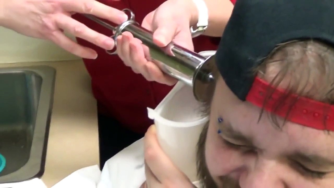 Impacted Ear Wax Removal (This Is Gross)