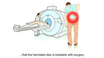 A herniated disc - What is it and what surgical treatments are available?