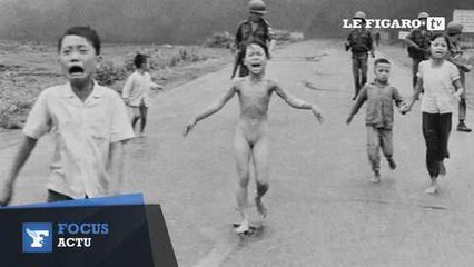 Les brûlures de la "petite fille au napalm" soignées 40 ans après