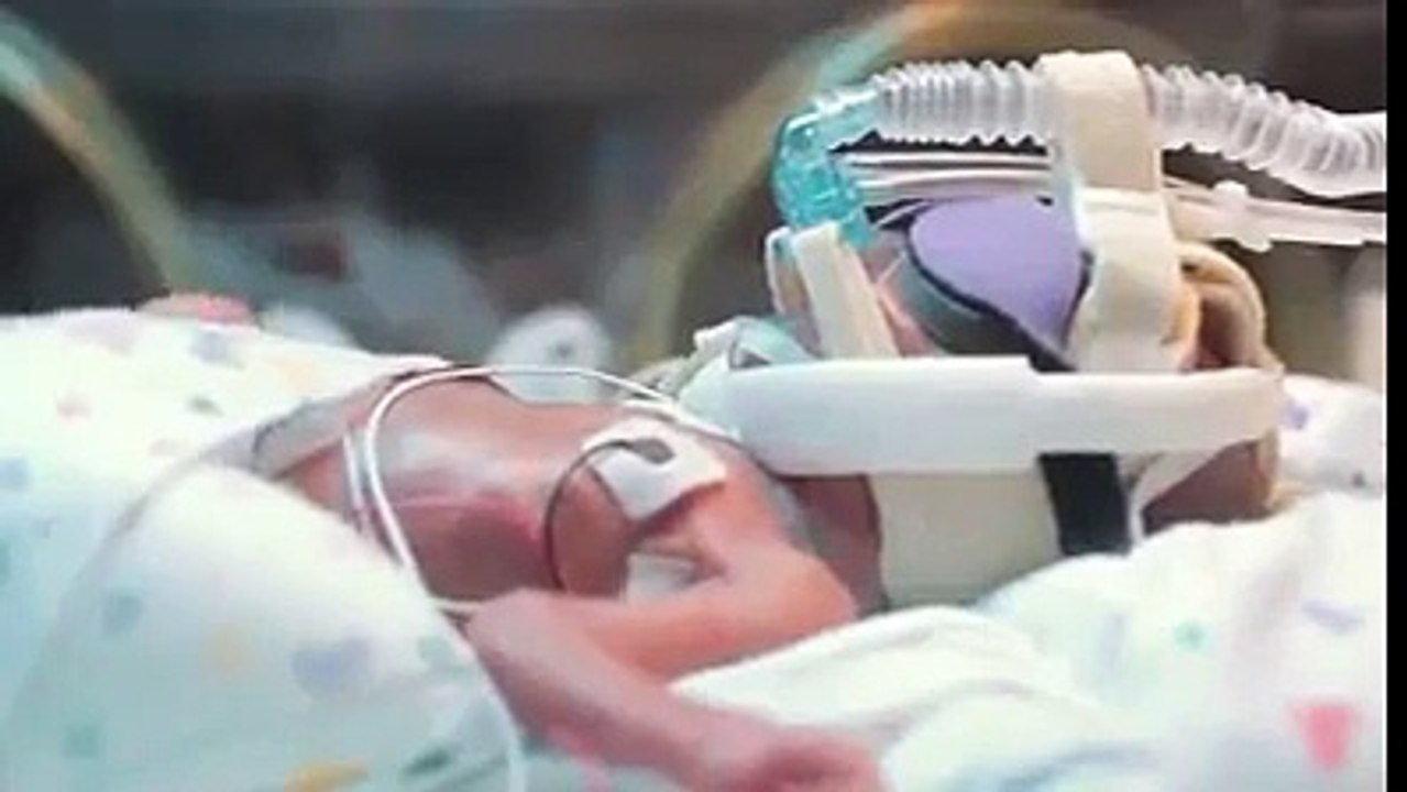 Bebe Prematuro Y El Milagro De La Vida