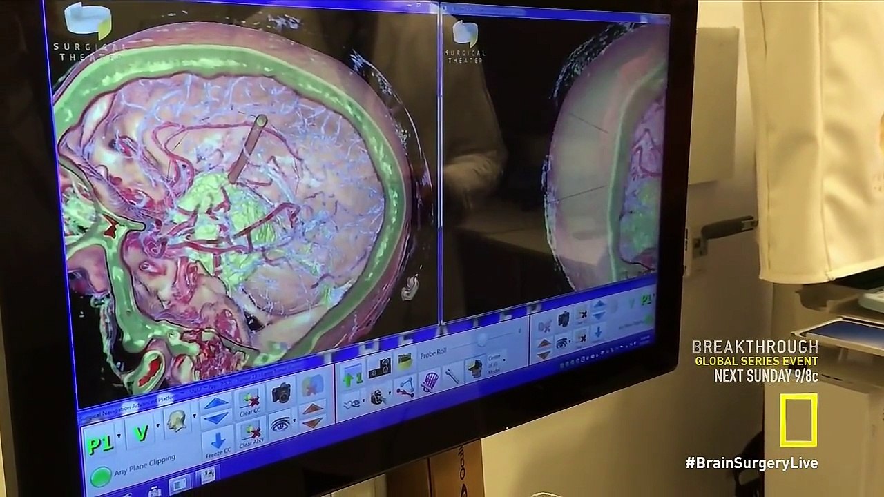 Brain Surgery Live 720p