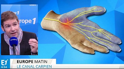 Le syndrome du canal carpien, qu'est-ce que c'est ?