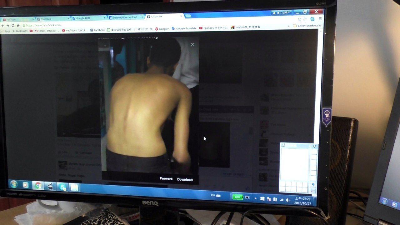 1219 lifting a tree root hurt back 拔樹根傷到背後