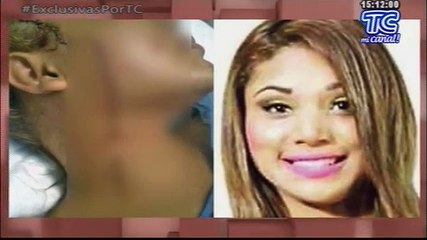 Madre de joven agredida muy dolida por terrible agresión hacia su hija