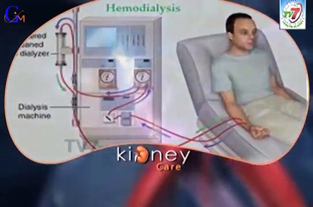 kidney function|kidney failure symptoms|kidney failure | Dr Sree Bhushan Raju | Nims Hospi