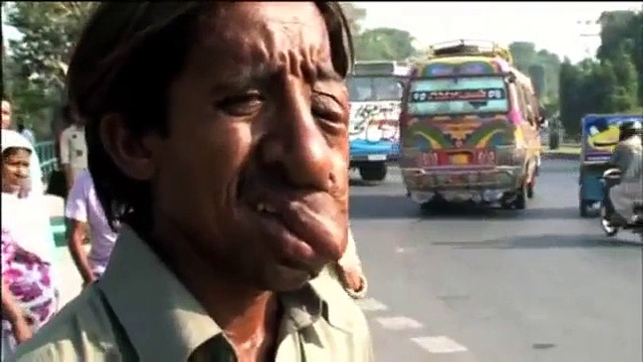 Человек с самой большой головой в мире