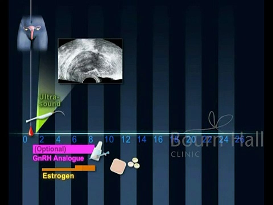 Protocol Cryopreserved Embryos - Bourn Hall Clinic India