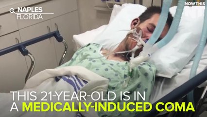 Man Goes Into Coma After E-Cigarette Blows Up In His Face