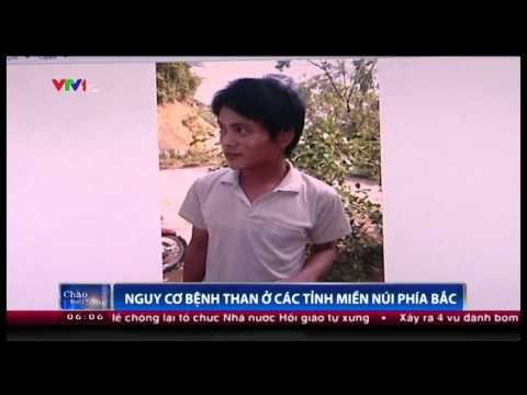 Nguy cơ bệnh than ở các tỉnh miền núi phía Bắc