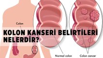 Kolon Kanseri Belirtileri Nelerdir?