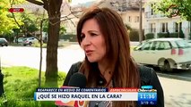 Raquel Argandoña reaparece con un supuesto retoque en su rostro | Matinal de CHV