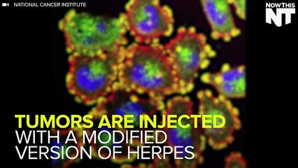 Can The Herpes Virus Be Used To Cure Cancer?