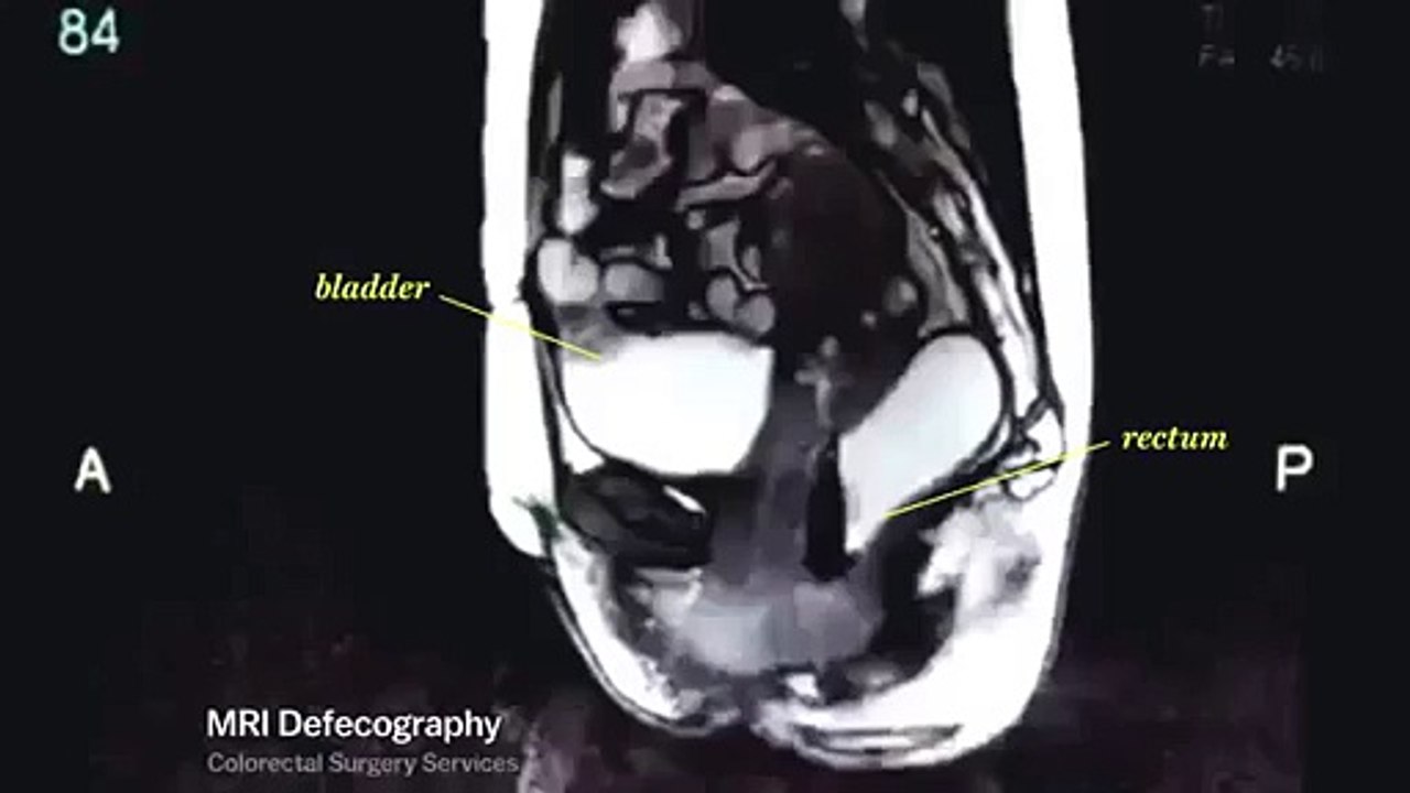 Human Body through an MRI machine