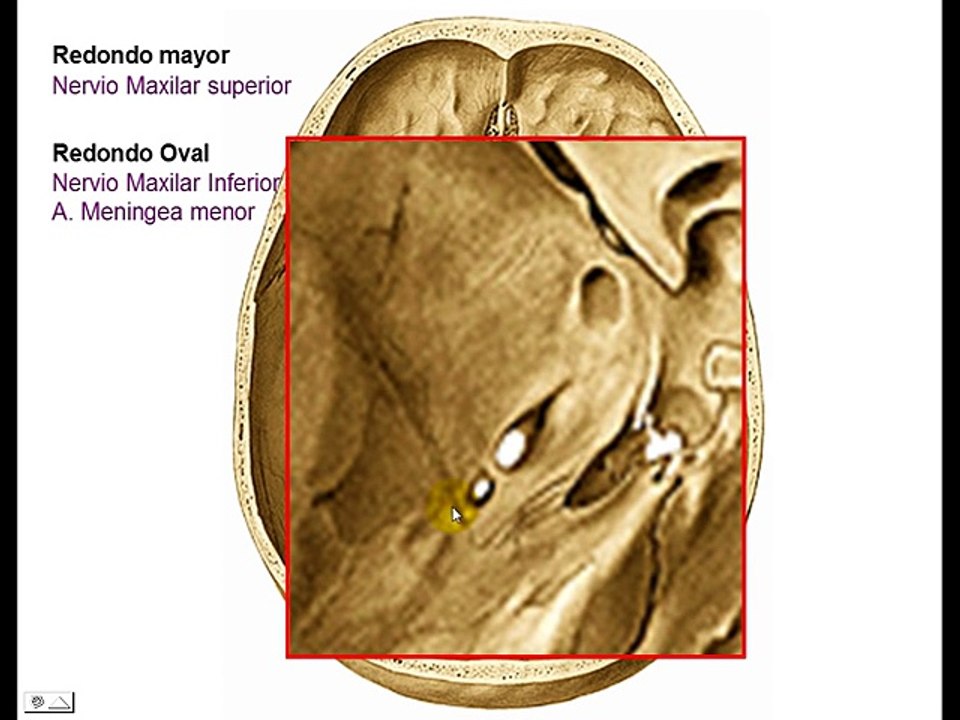 AGUJEROS DE BASE DE CRÁNEO