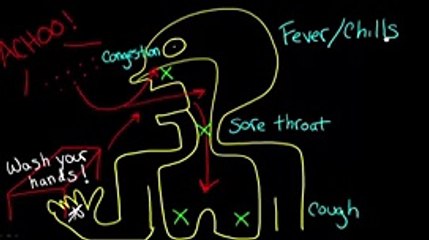 Influenza 01 Flu Symptoms and Diagnosis