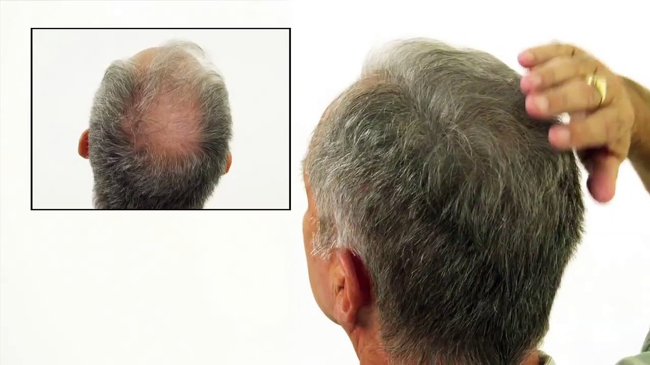 caboki/toppik contre pluie et vent algerie 0550603425 /ضد المطر والرياح والعرق