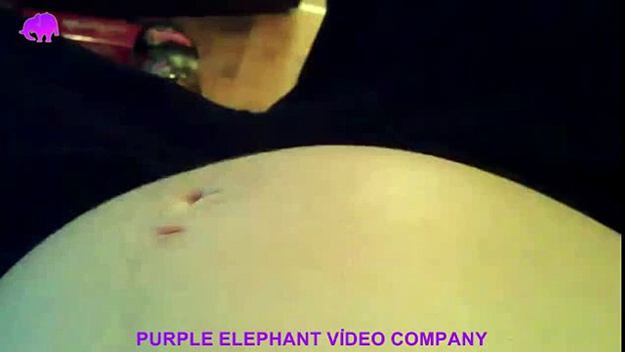 Twin boys (Luke and Nick) kicking at 23 weeks